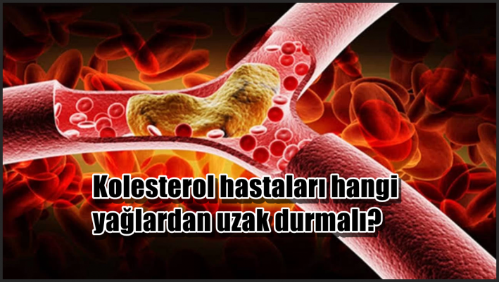 <Kolesterol hastaları hangi yağlardan uzak durmalı.....