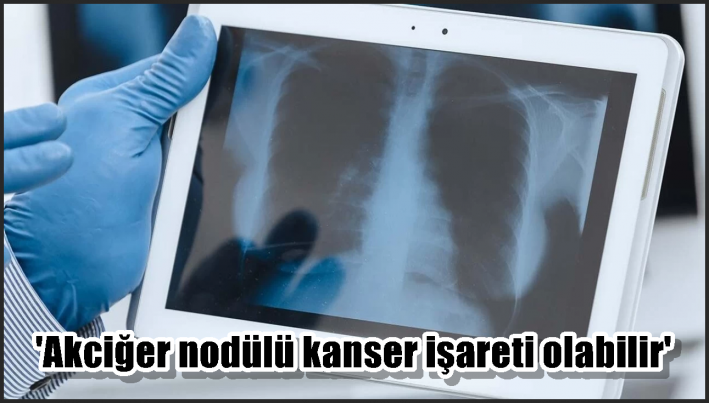 <’Akciğer nodülü kanser işareti olabilir’